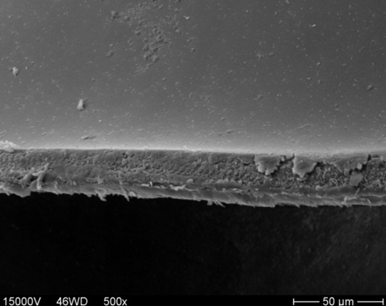 Край капсулорексиса, снимок получен при помощи электронного микроскопа.